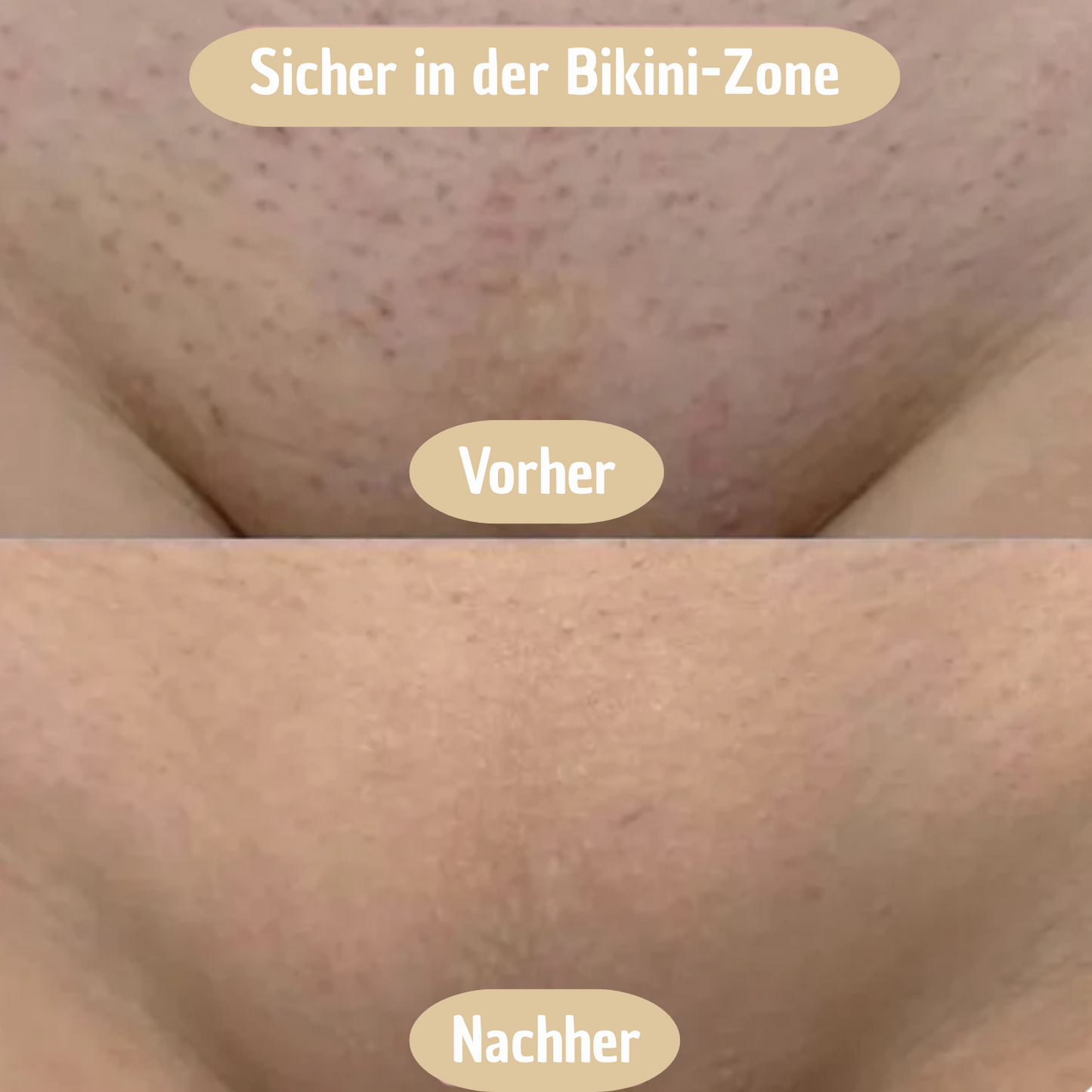 SilkTrim - 2 in 1 Damen Körperrasierer